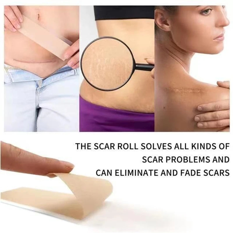 Waterproof & Reusable Silicone Scar Tape – Breathable, Skin-Friendly Adhesive for Ear Protection & Discreet Coverage